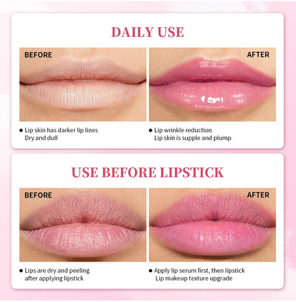 Natural Pink Serum Lips Pink Fresh Remove Dark Lips Gel Clareador Essência Creme Bálsamo Reparador de Linhas Finas Clareador Esfoliante Labial