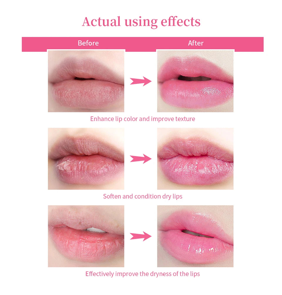 Natural Pink Serum Lips Pink Fresh Remove Dark Lips Gel Clareador Essência Creme Bálsamo Reparador de Linhas Finas Clareador Esfoliante Labial